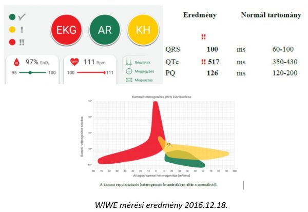 wiwe-eredm